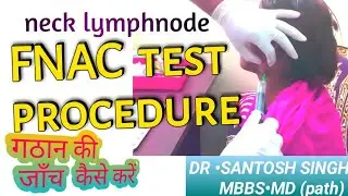 Fnac Test Technique and Procedure for Neck Lymphnode | TB ki Jaanch