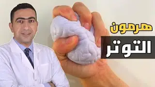 اعراض ارتفاع هرمون التوتر | ارتفاع الكورتيزول خطر يهدد حياتك