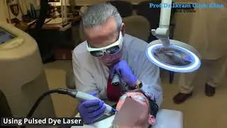 Laser Blast: Port Wine Stain Treatment! #lasertreatment #portwinestain