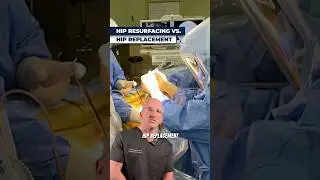 Why Is Hip Replacement More Popular Than Hip Resurfacing⁉️
