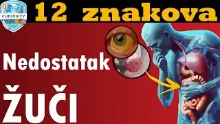12 znakova Nedostatak žuči u crijevu #Dr113
