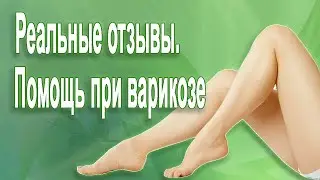 Реальные отзывы о продукции АРГО. Помощь при варикозе.