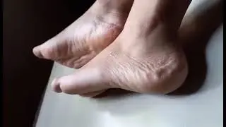 Soft soles