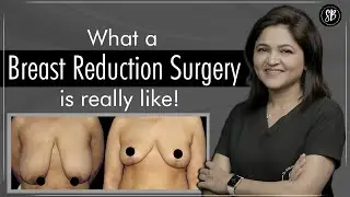 How to Reduce Breast Fat? | Solution for Heavy Breasts | Breast Reduction Surgery in Gurgaon