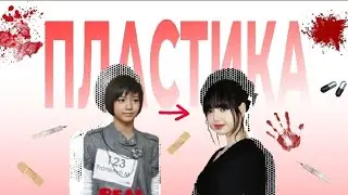 АЙДОЛЫ, КОТОРЫЕ ДЕЛАЛИ ПЛАСТИКУ|Blackpink, Bts, Enhypen, Txt и другие