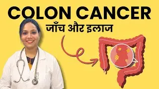 Colon Cancer Ki Jaanch Kaise Hoti Hai? Diagnosis and Treatment of Colon Cancer in Hindi