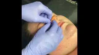 Nostril piercing