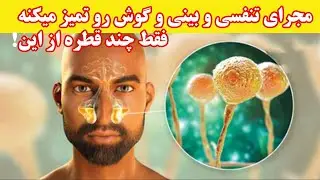 فقط چند قطره از این باکتری و ویروسها رو از بین میبمره! مجرای تنفسی و بینی و گوش رو تمیز میکنه