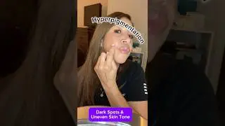 Products to treat dark spots & hyperpigmentation💋USE SUNSCREEN!🧴 #hyperpigmentation #darkspots