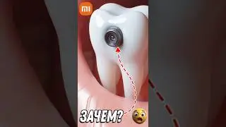 БОЛЯТ ЗУБЫ? Бери Xiaomi Скалер с КАМЕРОЙ! #xiaomi #aliexpress #shorts