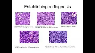 Use of molecular testing and NGS as Diagnosis Adjuncts and Response to Therapy
