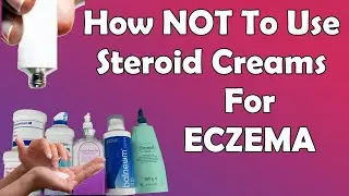 Why Your Steroid Cream For Eczema is Not Working