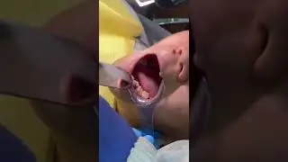 Tips dental photography with mobile phone