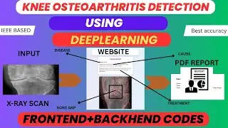 Knee Osteoarthritis Detection using Deep Learning | Best IEEE Based Machine learning Project 2025-26