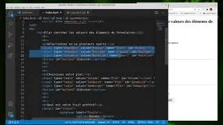 Capsule 3.3 - EventListener, checkbox et radio-bouton