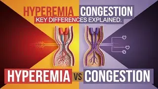 Hyperemia vs Congestion || General Pathology || Pathology Past Papers || Robbins || Hemodynamics