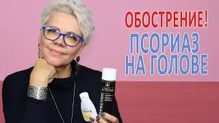 WORSE! PSORIASIS on the SCALP!