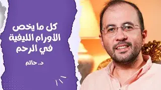 د. حاتم هيجاوب عن كل الاسئلة بخصوص الاورام الليفية في الرحم _ امتى نزيل الورم الليفي من الرحم