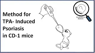 Method TPA induced psoriasis in CD-1 mice