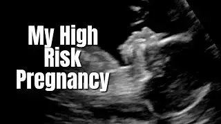 My high risk pregnancy | Mariah McLean