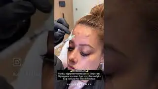 👋 BYE-BYE BUNNY LINES! 🐰
