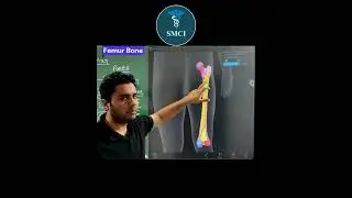 Femur bone | External features | Revision | Anatomy