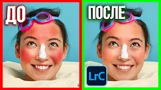 КАК УБРАТЬ КРАСНОТУ в лайтруме - уроки лайтрума для начинающих
