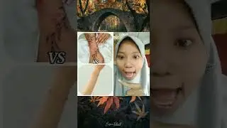 Gigiku Gak Pake Behel 🐭🐭‼️‼️