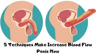 5 Techniques Make Increase Blood Flow Penis Now The Technique Makes The Penis Bigger Naturally