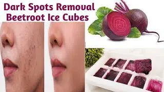 Dark Spots Removal Beetroot Ice Cubes | Beetroot Ice Cubes for Fair, Spotless & Pinkish Glowing Skin