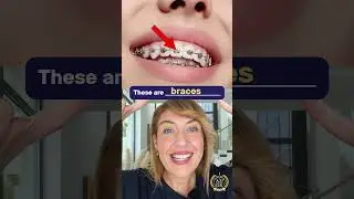 TEETH 🦷 Vocabulary (Part 2)