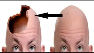 دمج صورة مع صورة بالفوتوشوب (الراس المفتوح) #photoshop