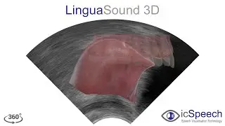 Ultrasound Tongue Imaging (UTI)
