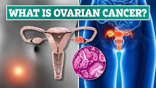 The ‘silent’ symptom of killer ovarian cancer you can spot on the loo