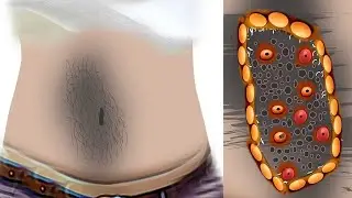 ASMR Dirty Belly Cleaning