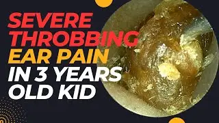 Severe Throbbing Ear PAIN In 3 Years Old Kid