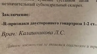 МСЭ вернула документы обратно в поликлинику. Рентген на бумаге уже не подходит. 🤬😇