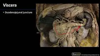 Abdominal Viscera - Dissection Supplement