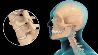 Spine in Motion