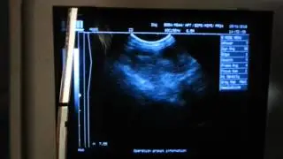 20160115 094803