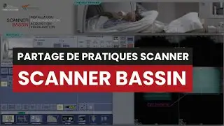 CT SCANNER BASSIN - Partage de pratique