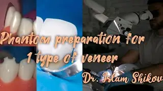 Phantom preparation for 1 type of veneer. Dr. Islam Shikov