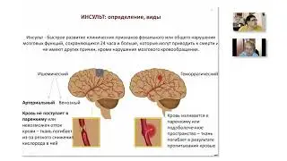 Школа клинического мышления педиатра. Артериальный ишемический инсульт у детей