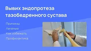 Вывих эндопротеза тазобедренного сустава