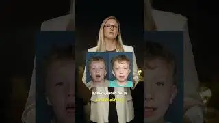 ДЫХАНИЕ ЧЕРЕЗ РОТ И ДЕФОРМАЦИЯ ЛИЦА