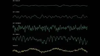 Distant Era (Original; Yamaha DX7 + Roland R-8)