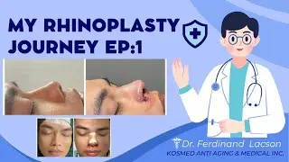 Affordable Nose Job: “My KOSMED Rhinoplasty Journey”