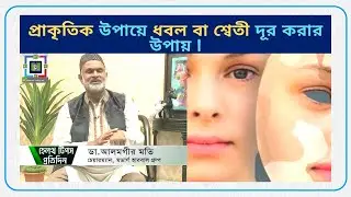 Why is skin white? | How To Get Rid Of Skin White Disease Naturally | Modern Health Bd