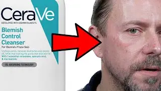 CeraVe DID THIS TO MY SKIN!