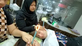 $3.50 EAR CANDLING 🇮🇩 Jakarta Indonesia 4K